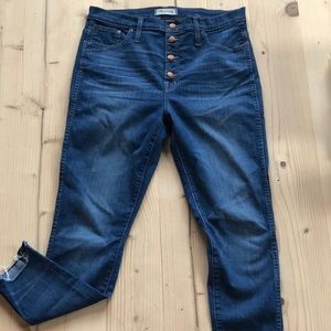 Madewell 10 inch rise Button fly skinny jeans